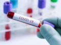 За минувшие сутки коронавирус в Украине обнаружили у 1746 человек