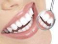Причины белых пятен на зубах