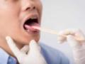 Онколог Мудунов назвал онемение во рту одним из симптомов рака языка