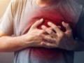 Названі нові симптоми серцевого нападу