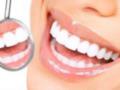 Найпопулярніші та дієві засоби відбілювання зубів
