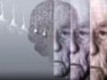 Комплексні заходи для ефективної профілактики хвороби Альцгеймера