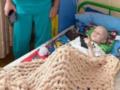 В Киеве впервые в мире установили уникальный протез 6-летнему мальчику