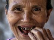 Проблемы с зубами повышают риск развития рака - ученые