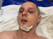 В Киеве избили музпродюсера хита группы KAZKA М‘ята
