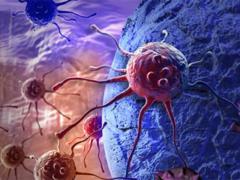 Ученые обнаружили фактор, сигнализирующий о развитии рака