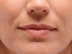 Морщины вокруг рта: откажитесь от вредных привычек