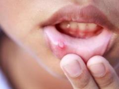 Учёные рассказали о признаках болезней видных в полости рта
