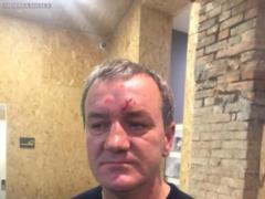 Титушки сорвали эфир Гриценко в Одессе, есть пострадавшие