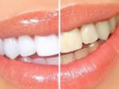 6 продуктов, которые помогут сделать зубы светлее