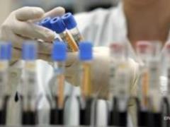 В Украине есть необходимые тест-системы для диагностирования нового коронавируса