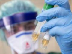 В КНР перестали учитывать зараженных коронавирусом без симптомов