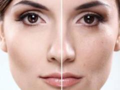 Как сделать поры на лице менее заметными: 8 простых способов Как сделать поры на лице менее заметными: 8 простых способов