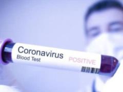 У топ-чиновника Ирана обнаружили смертельный коронавирус