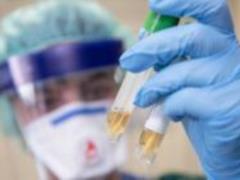 В украинских лабораториях появятся тесты на выявление коронавируса COVID-19