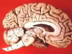 Вы удивитесь: 6 заблуждений относительно головного мозга