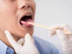 Онколог Мудунов назвал онемение во рту одним из симптомов рака языка