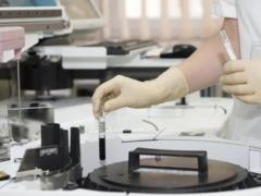 В Украине зафиксировали вспышку вируса Коксаки - на Киевщине заболели 13 детей