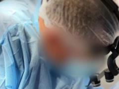 Подруга девушки, которая умерла во время пластической операции в Киеве, рассказала подробности трагедии