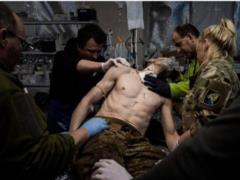 В Україні фіксують хворобу, якої не було від часів Першої світової війни