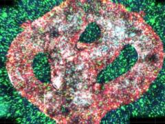 Виноват известный вирус: ученые нашли причину развития опасного рака