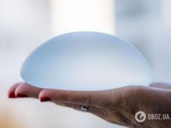 Маммопластика без долгой реабилитации: что меняет современная хирургия