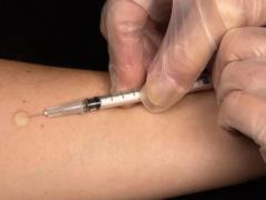 Уходит эпоха Манту: с апреля Украина переходит на новые методы выявления туберкулеза