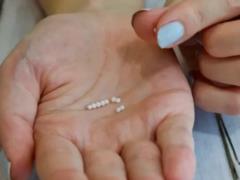 Пеллеты и longevity: что такое “имплант здоровья” и зачем он нужен