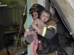 В Одессе из больницы выписали девочку, фото которой после обстрела разлетелось по сети