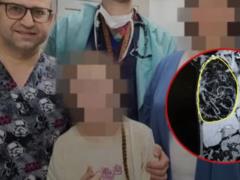 Во Львове медики удалили 4-килограммовую опухоль у 12-летней девочки